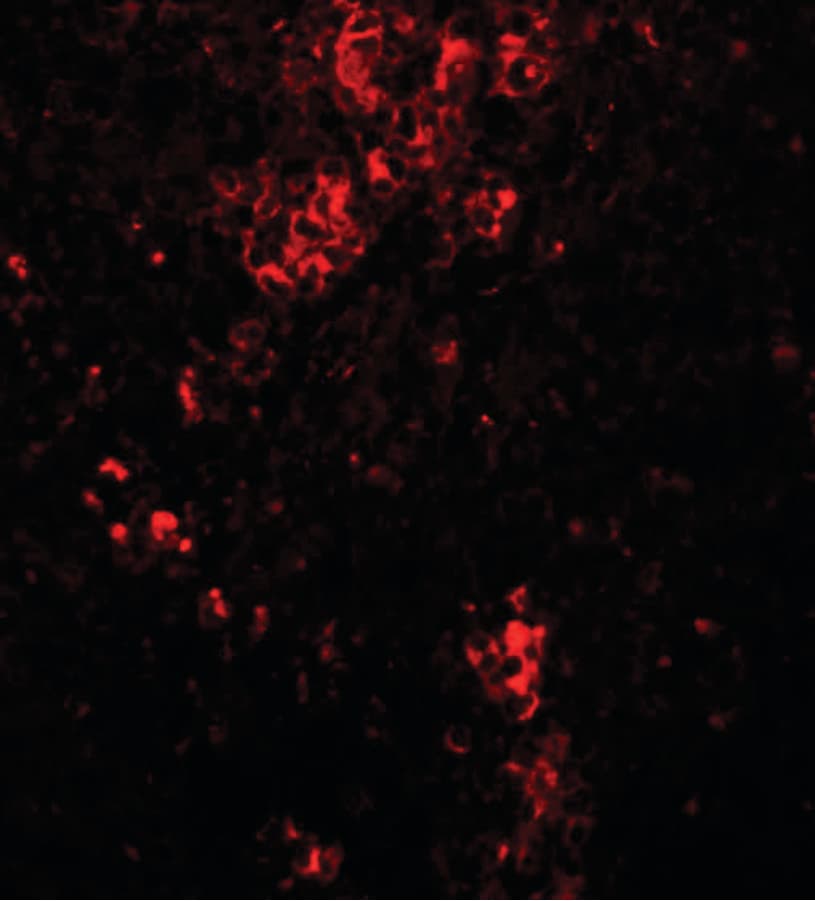 IHC-plus™ BAR / BFAR Antibody