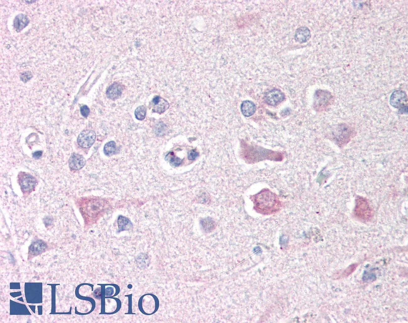 IHC-plus™ Polyclonal Rabbit anti-Human ISG15 Antibody (IHC, WB)