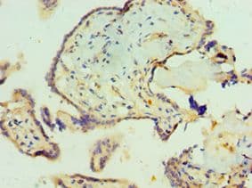 Polyclonal Rabbit anti-Human SCP2 / SCPX Antibody (aa1-322, IHC)