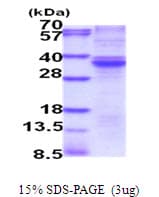 Human RASD2 Protein (Recombinant His)