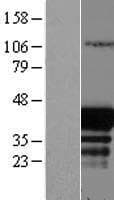 EAF1 / ELL Associated Factor 1 Protein (Over-Expression Lysate Myc-DDK (Flag))