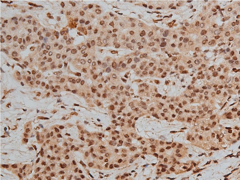 Polyclonal Rabbit anti-Human HDAC3 Antibody (phospho-Ser424, IHC, IF, WB)