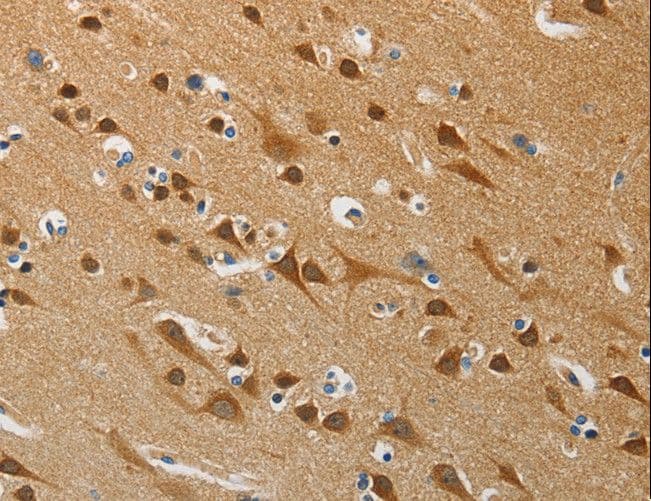 APG4B / ATG4B Antibody
