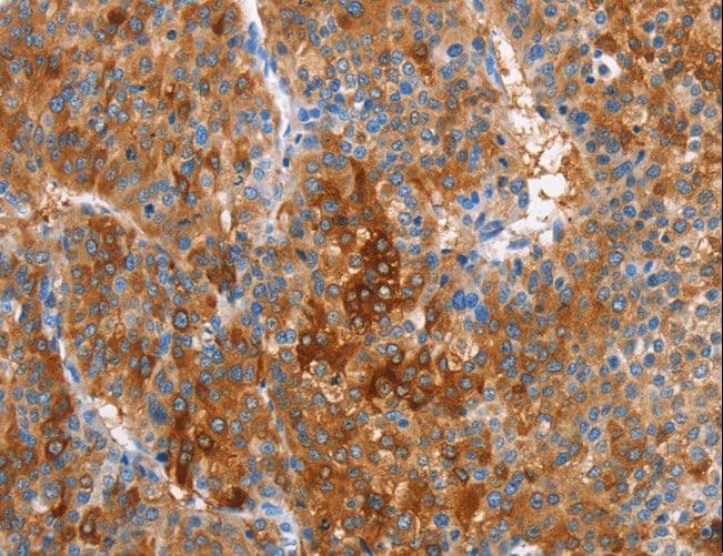 CBS Antibody