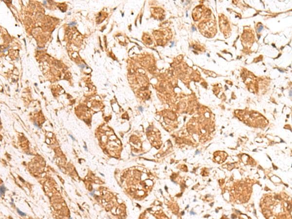 GANC Antibody