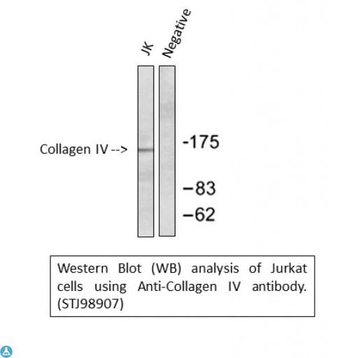 Monoclonal Mouse anti-Human Collagen IV Antibody (WB)