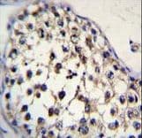 Polyclonal Rabbit anti-Human FUT8 Antibody (aa329-357, IHC, WB)