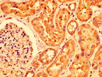 PLXNB1 / Plexin-B1 Antibody