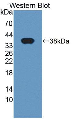 Polyclonal Rabbit anti-Human LASP1 Antibody (Biotin, aa1-261, WB)