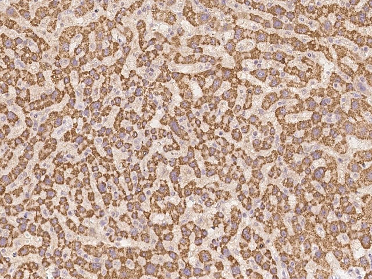 Polyclonal Rabbit anti-Human GABPB2 Antibody (IHC)