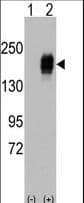 EGFR Antibody (Tyr978)