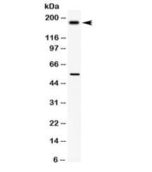 COL1A1 / Collagen I Alpha 1 Antibody (aa1194-1218)