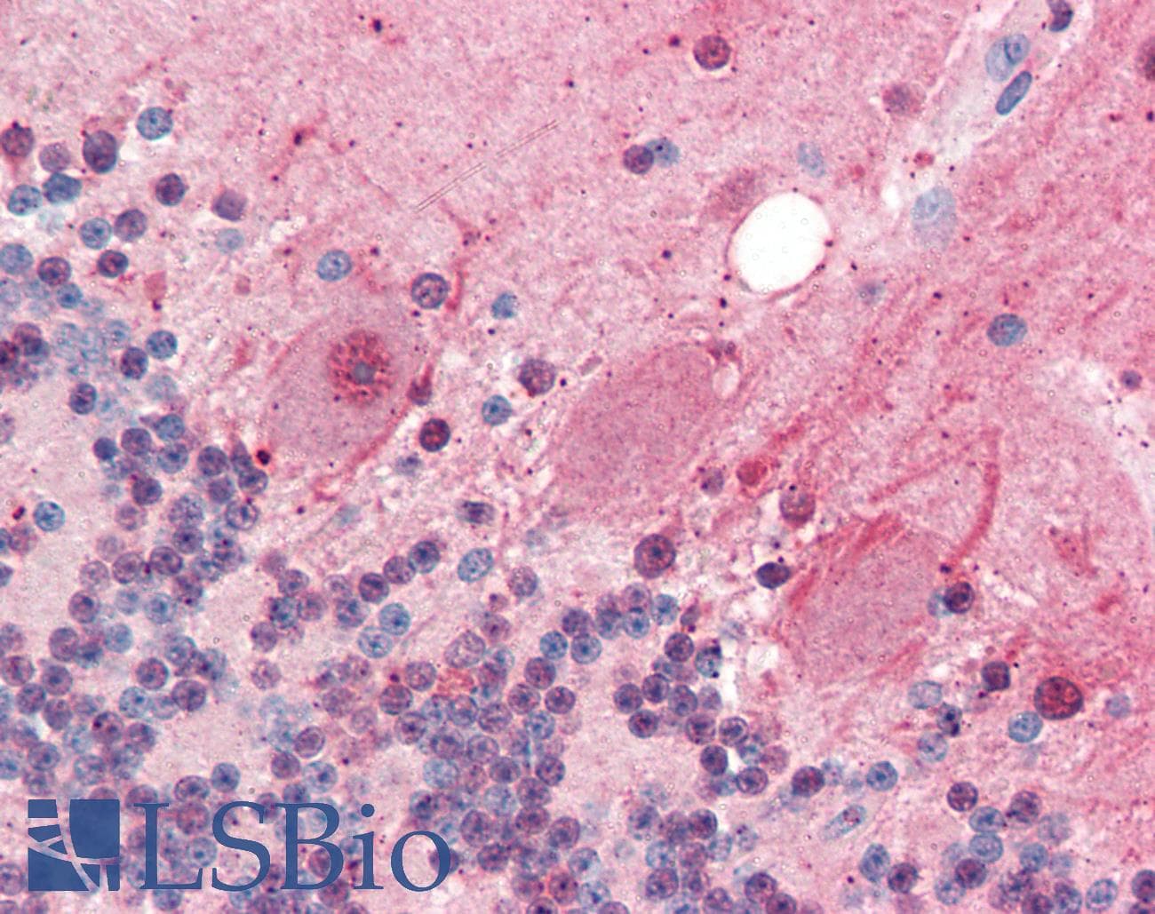 IHC-plus™ Polyclonal Rabbit anti-Human SIRT2 / Sirtuin 2 Antibody (IHC, IF, WB)