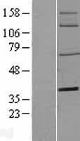 NT5E / eNT / CD73 Protein (Over-Expression Lysate Myc-DDK (Flag))