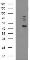 FDFT1 / Squalene Synthase Antibody (clone OTI1H9)