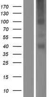 TMEM184A Protein (Over-Expression Lysate Myc-DDK (Flag))