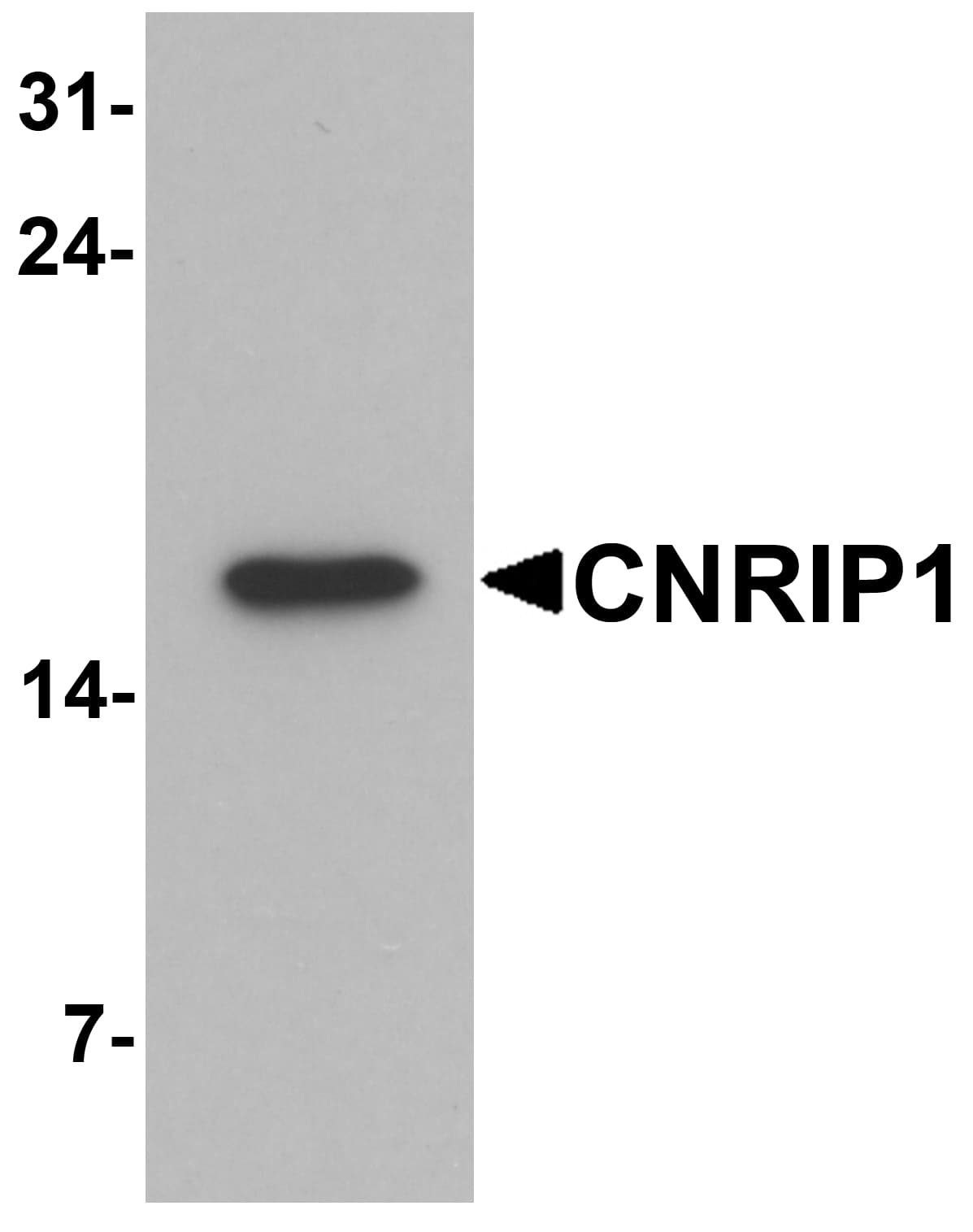 IHC-plus™ Polyclonal Rabbit anti-Human CNRIP1 Antibody (IHC, IF, WB)