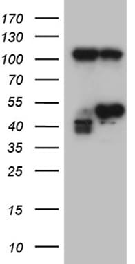 HDAC8 Antibody (aa1-243, clone OTI1B2)