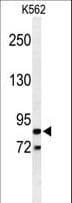 AVIL / Advillin Antibody (aa176-204)