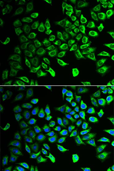 Polyclonal Rabbit anti-Human DDAH2 Antibody (IHC, IF, WB)