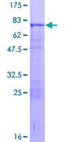 Human ETS2 Protein (Recombinant GST)