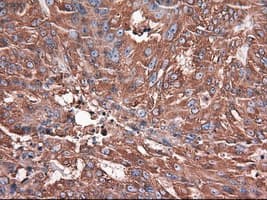 Monoclonal Mouse anti-Human CPA1 / Carboxypeptidase A Antibody (clone OTI2A3, IHC, IF, WB)
