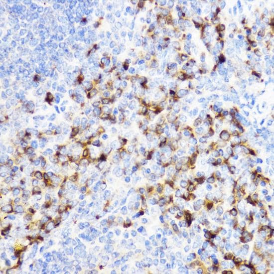 Polyclonal Rabbit anti-Human CHI3L1 / YKL-40 Antibody (IHC, IF)