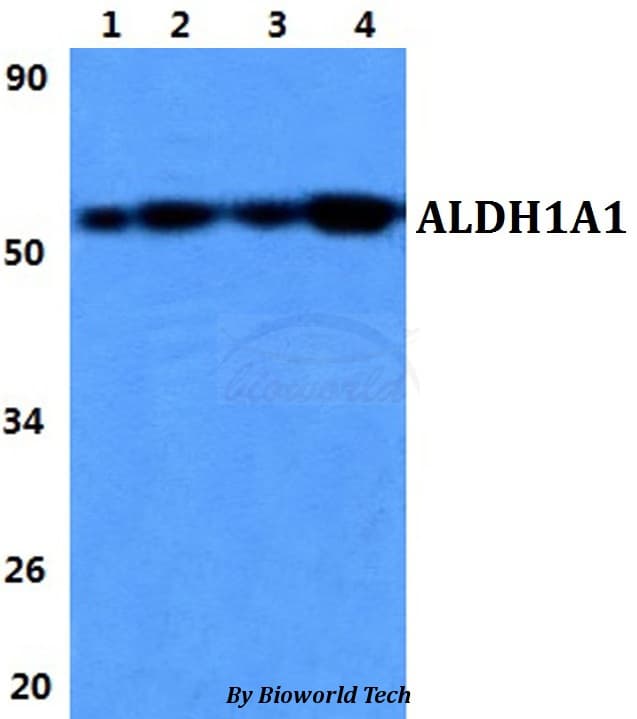 Polyclonal Rabbit anti-Human ALDH1A1 / ALDH1 Antibody (IHC, WB)