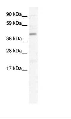 SMARCB1 / INI1 Antibody (aa40-89, Biotin)