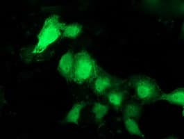 PNMT Antibody (clone OTI1B11)