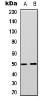 Polyclonal Rabbit anti-Human SLC16A3 Antibody (Internal, WB)