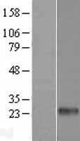 CLEC6A / Dectin 2 Protein (Over-Expression Lysate Myc-DDK (Flag))