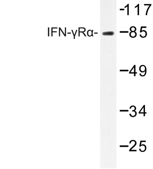 CD119 / IFNGR1 Antibody (Gly456)