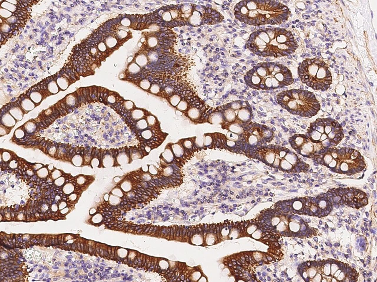 KRT12 / CK12 / Cytokeratin 12 Antibody