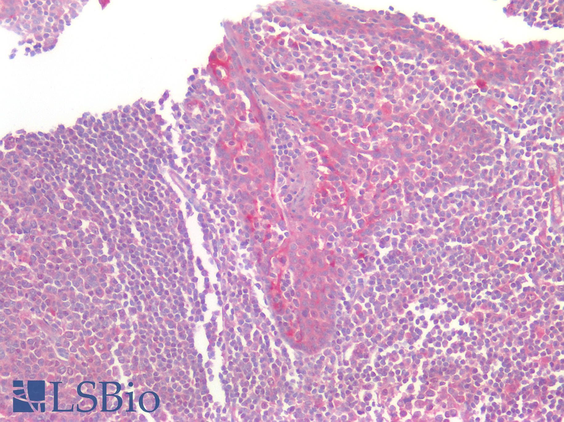 PathPlus™ GPR160 Antibody (Extracellular Domain)
