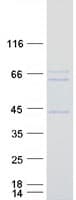 Human RAI2 Protein (Recombinant Myc-DDK (Flag))