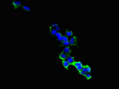 GIPR / GIP Receptor Antibody