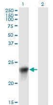 GHBP / BLVRB Antibody (clone 2F4)