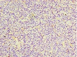 IL27RA Antibody (aa33-283)