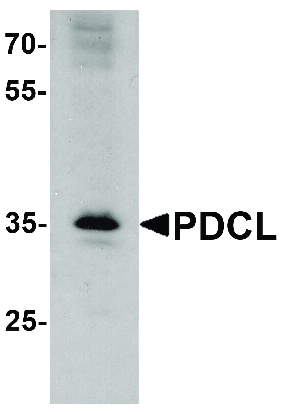 PDCL Antibody