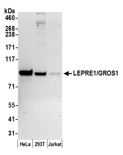 P3H1 / LEPRE1 Antibody (aa200-250)