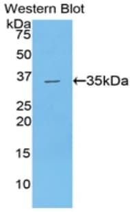 CPB2 / TAFI Antibody (aa138-423)