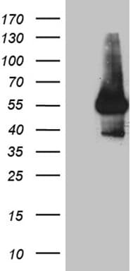 IL15RA Antibody (aa31-267, clone OTI6B2)