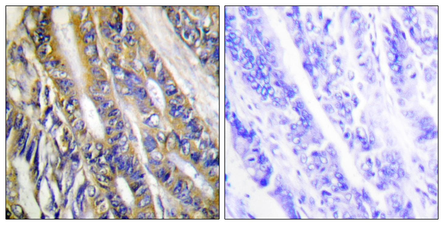 DGKeta / DGKH Antibody