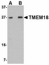 IHC-plus™ TMEM18 Antibody