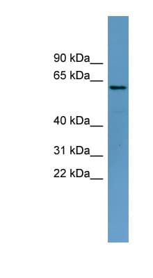 Polyclonal Rabbit anti-Human TOM1 Antibody (aa359-408, WB)