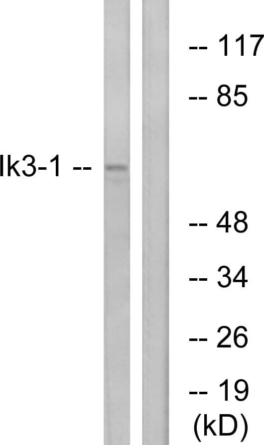 Polyclonal Rabbit anti-Human IK3-1 / CABLES1 Antibody (aa561-610, WB)