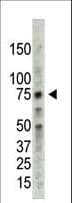 Polyclonal Rabbit anti-Human PRMT5 Antibody (aa591-621, IHC, WB)