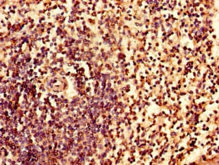 Polyclonal Rabbit anti-Human IRF7 Antibody (IHC, IF)