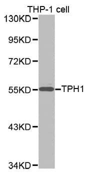 IHC-plus™ TPH1 / Tryptophan Hydroxylase Antibody